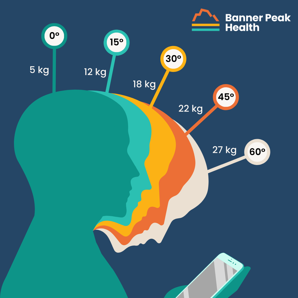 Infographic: Text Neck: The Hidden Epidemic We Shouldn’t Ignore
