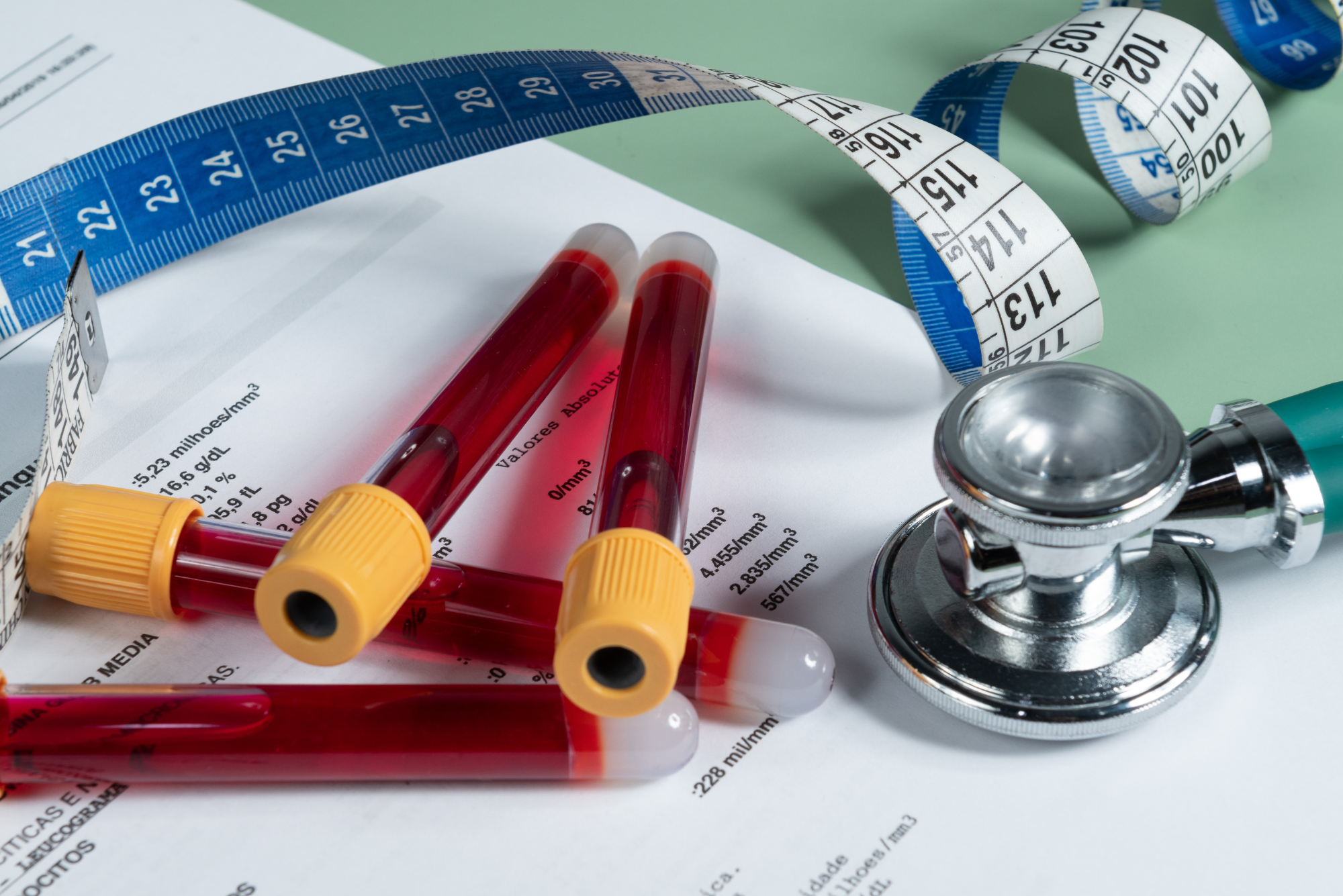 Blood test tubes, measuring tape, stethoscope, and lab report suggesting a medical exam or metabolic panel assessment.